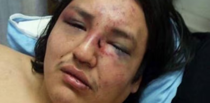 After being beaten and marched naked through RCMP detachment, Siksika man sues Mounties | CBC News