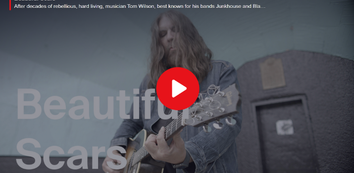 Beautiful Scars | TVO Today