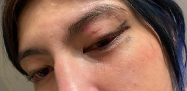 First Nations woman in Winnipeg says cab driver attacked her