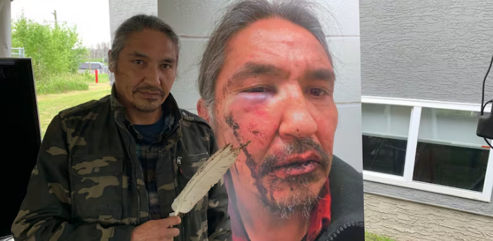 Investigation launched after northern Alberta chief accuses RCMP of assault | CBC News