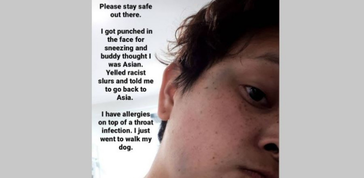 Man shouts racist slurs, hits woman in face after she sneezes while walking dog in East Vancouver | CityNews