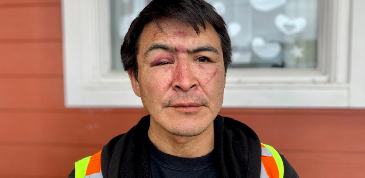 RCMP investigating two alleged attacks on Dene man in Yellowknife | APTN News